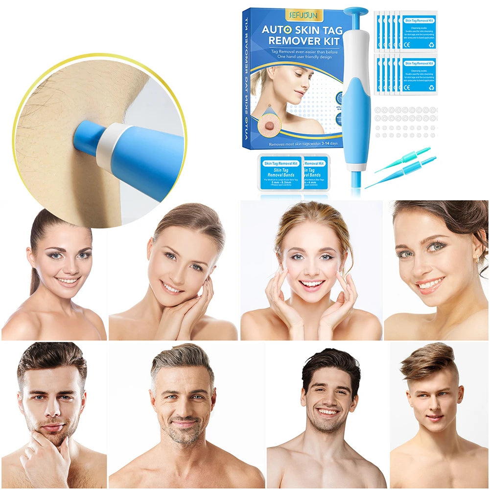 Rubber Rings Skin Tag Removal Tool Face Beauty Accessories Skin Tag Removal Device Multipurpose Supplies for Face Neck Chin Back