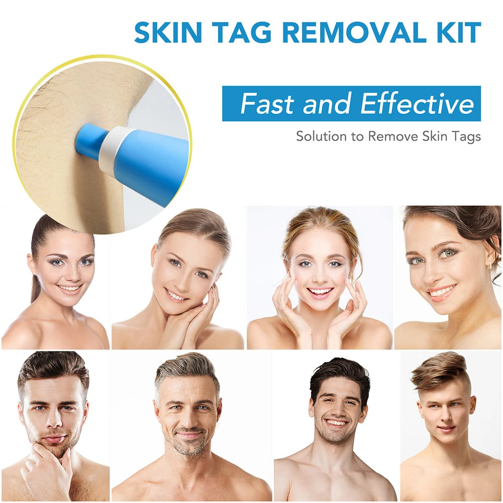Rubber Rings Skin Tag Removal Tool Face Beauty Accessories Skin Tag Removal Device Multipurpose Supplies for Face Neck Chin Back